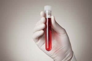 blood-test-at-abortion-consultation